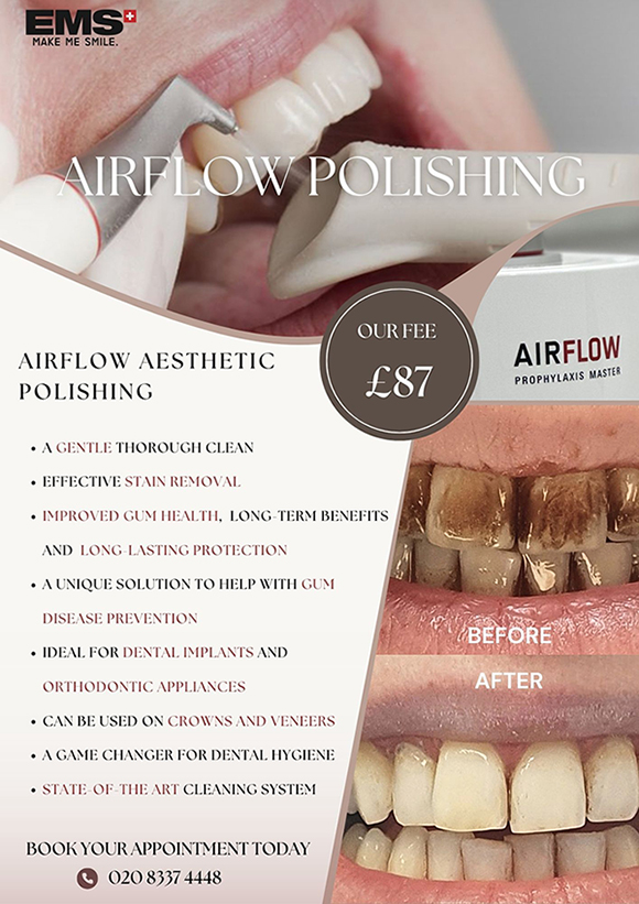 airflow polishing